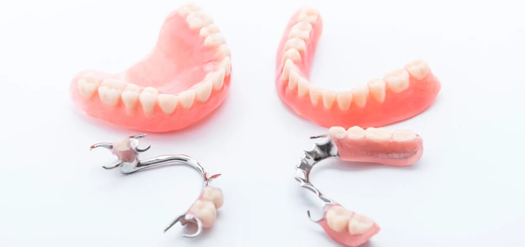 proth se fixe amovible dentiste anthony Implantologie Cabinet dentaire Le 29 Bis, Chirurgiens-dentistes à Antony 92160