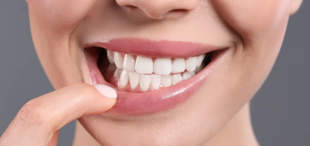 soins gencives detartrage Gencives Cabinet dentaire Le 29 Bis | Chirurgiens-dentistes | Antony 92160