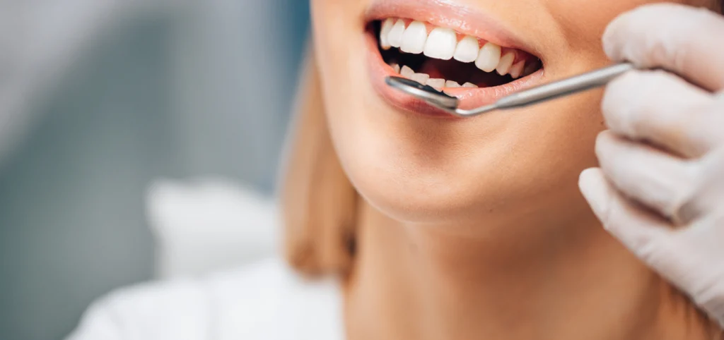 sourire Facettes dentaires Cabinet dentaire Le 29 Bis | Chirurgiens-dentistes | Antony 92160