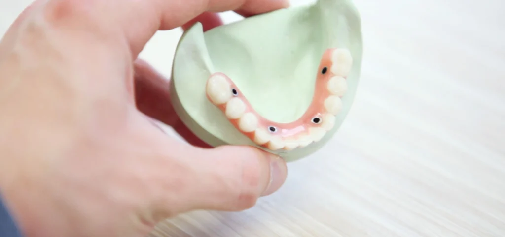 implant dentaire protheses Omnipratique Cabinet dentaire Le 29 Bis | Chirurgiens-dentistes | Antony 92160