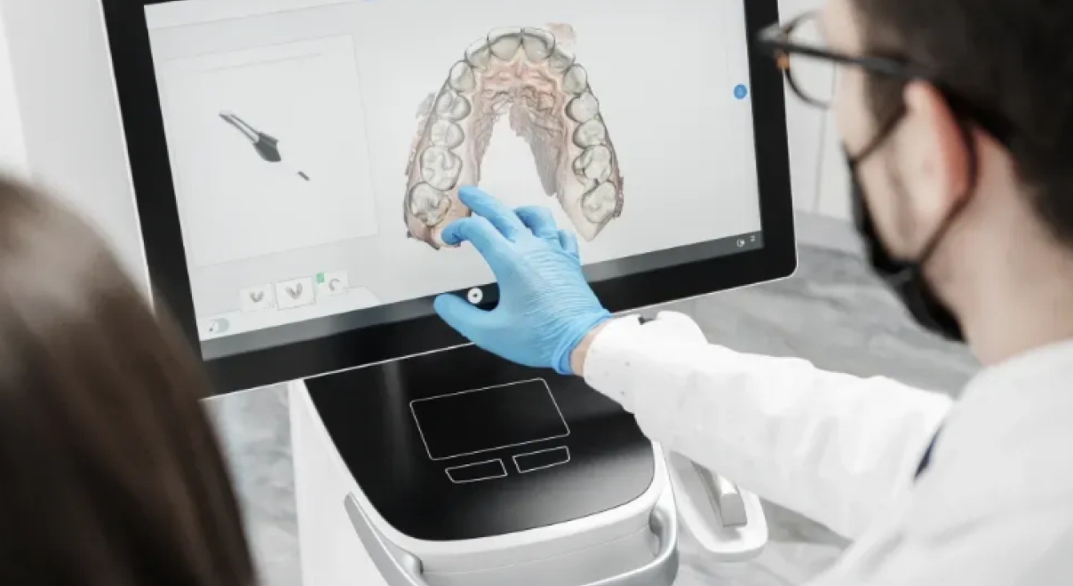 empeinte optique dentiste anthony